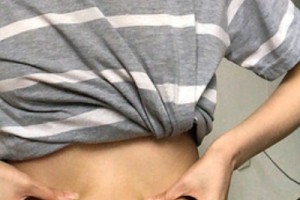 武漢涵美整形醫(yī)院怎么樣？吸脂減肥實(shí)拍—術(shù)后恢復(fù)