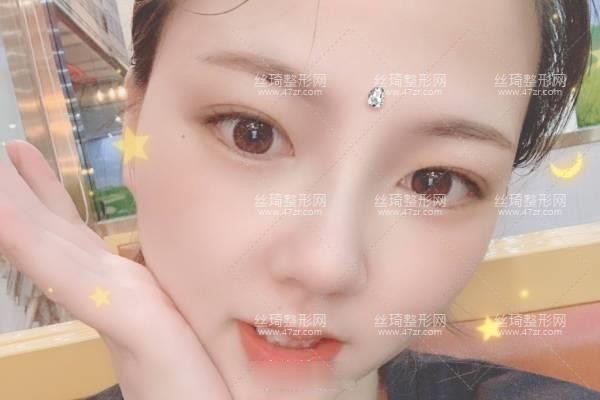 上海生命樹(shù)醫(yī)療美容醫(yī)院怎么樣？鼻部手術(shù)價(jià)目表和醫(yī)生推薦