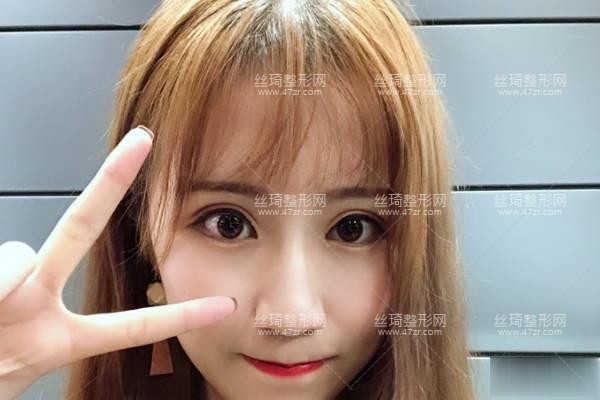 衡陽(yáng)附一美容科隆鼻怎么樣附手術(shù)介紹專(zhuān)家口碑點(diǎn)評(píng)