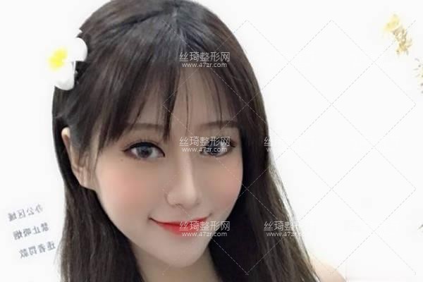 寧波第三醫(yī)院整形美容科怎么樣？鼻部手術(shù)價目表和醫(yī)生推薦