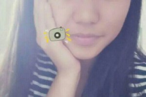 綿陽中心醫(yī)院美容科價格表 全切雙眼皮