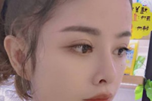 青醫(yī)附院環(huán)境好不好？雙眼皮案例&2021價格表！