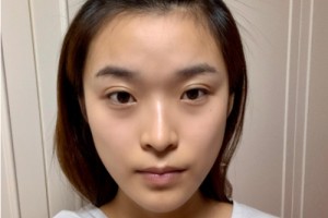 合肥曙光醫(yī)院植發(fā)怎么樣？附2021價(jià)格表