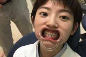 可恩口腔醫(yī)院靠譜嗎？美白牙齒項目測評