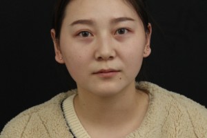 鄭州天后醫(yī)院隆鼻整形正規(guī)嗎？醫(yī)院簡介—醫(yī)生名單