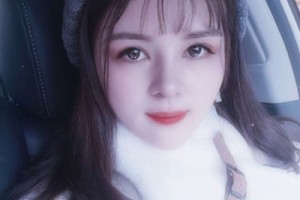 北京協(xié)和醫(yī)院整形外科價(jià)格？假體隆鼻術(shù)后恢復(fù)！