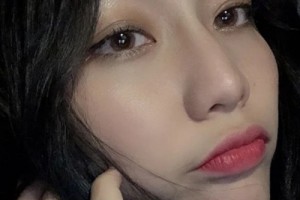 米格醫(yī)療美容醫(yī)院假體隆鼻果？案例+價格表