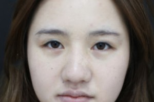 301整形科好不好？醫(yī)院介紹+2021超全價(jià)格表