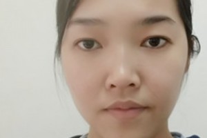 廣州新生毛發(fā)醫(yī)院植發(fā)怎么樣？靠譜嗎？2021價格表