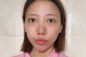 廣州善伊整形口碑如何？醫(yī)生名單+較新費(fèi)用表優(yōu)惠