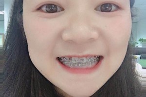 沈陽康貝佳口腔牙齒矯正怎么樣/醫(yī)生介紹+名單！