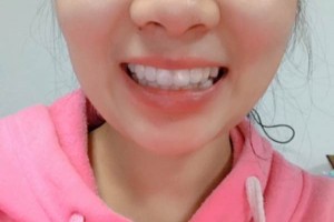長沙市口腔醫(yī)院牙齒矯正多少錢？案例測評+價(jià)格表