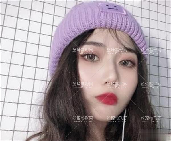 九院整形隆鼻3個(gè)月果|整形專家詳情