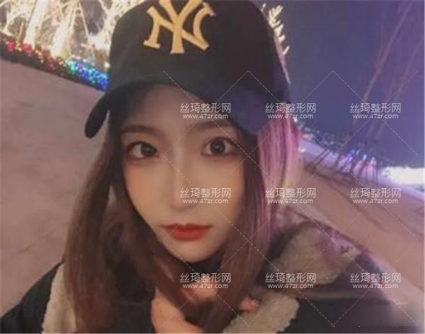 上海第九人民醫(yī)院美容整形科怎么樣？隆鼻實拍案例圖價格費醫(yī)生口碑