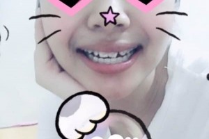 青島可恩口腔醫(yī)院牙齒矯正靠譜嗎？圖片對比+價(jià)格表