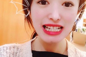 南京雅度口腔醫(yī)院怎么？術(shù)后反饋+醫(yī)生介紹