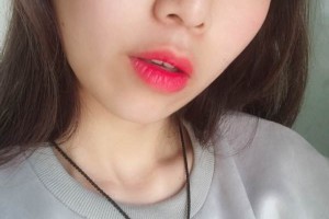 鄭大一附院整形科|雙眼皮術后恢復+醫(yī)生介紹