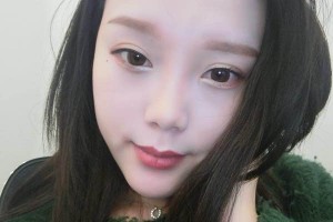 河南省人民醫(yī)院雙眼皮成功案例在線分享！
