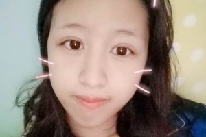 北京愉悅醫(yī)美雙眼皮口碑？醫(yī)院簡(jiǎn)介+案例