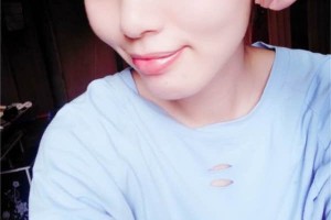 北京協(xié)和整形科｜雙眼皮術(shù)后反饋+費(fèi)用明細(xì)