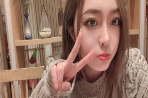 北京藝美醫(yī)療雙眼皮手術(shù)果如何？附2021價(jià)格表