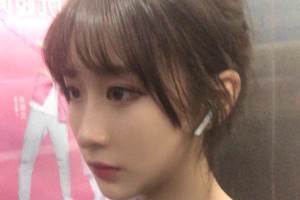 鄭州第一附院整形科靠譜嗎？下頜角真實案例圖