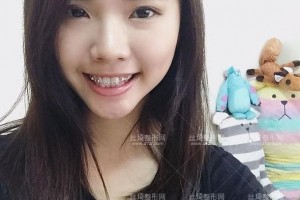 北京拜博口腔醫(yī)院靠譜嗎？附案例圖+價(jià)格表