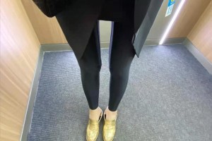 寧波六院整形科溶脂瘦身果如何？附案例圖速看！