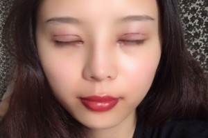 西安星伊美醫(yī)療整形怎么樣？附醫(yī)院簡介+雙眼皮日記