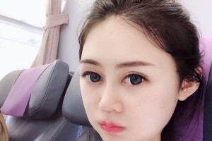 長沙葉子下頜角整形價格表？醫(yī)院介紹+醫(yī)生名單！