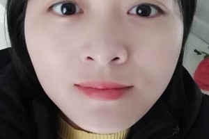 江蘇蘇州薇琳醫(yī)院正規(guī)嗎？下頜角術(shù)后果+價(jià)格表