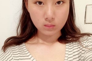 北京協(xié)和醫(yī)院整形外科下頜角醫(yī)生詳細(xì)介紹附價格表推薦！