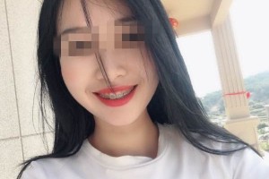 深圳福華口腔是正規(guī)醫(yī)院？牙齒矯正術(shù)案例|醫(yī)生口碑