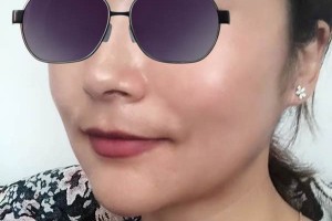 杭州邵逸夫醫(yī)院美容科下頜角好嗎？醫(yī)生介紹！