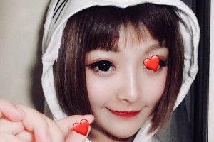 河南省人民醫(yī)院埋線雙眼皮/術(shù)前術(shù)后果對比！