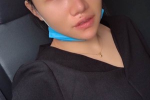 湘雅醫(yī)院皮膚激光中心哪位醫(yī)生好？眼部手術(shù)術(shù)前術(shù)后果對比！