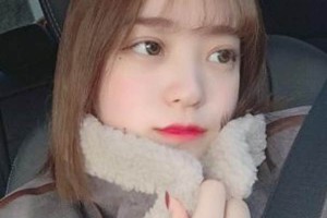 昆明延安醫(yī)院埋線雙眼皮正規(guī)嗎？術(shù)后案例實拍分享！