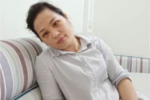 東莞同濟(jì)醫(yī)院是三甲嗎？眼部手術(shù)術(shù)前術(shù)后果對(duì)比！