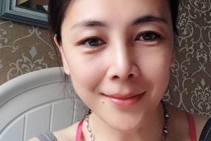 鄭州華領(lǐng)整形醫(yī)院硅膠隆鼻評價/術(shù)前術(shù)后果對比！