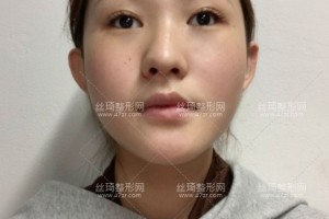 上海安縵醫(yī)療美容怎么樣？熱瑪吉反饋|醫(yī)生介紹