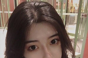 廈門新生毛發(fā)醫(yī)院是正規(guī)嗎？植發(fā)案例+醫(yī)院介紹