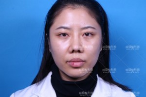 溫州附二醫(yī)激光美容科怎么樣？附案例圖+價格