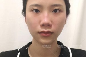 杭州浙一醫(yī)院有做熱瑪吉嗎？附果圖+價格表