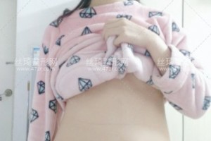 杭州浙醫(yī)一院吸脂費用貴不貴？附吸脂前后對比