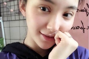 上海千美醫(yī)療美容院定點(diǎn)雙眼皮？術(shù)后術(shù)前明X果～