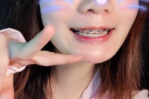 長沙中諾口腔醫(yī)院/牙齒矯正圖片對比！