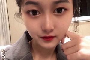 廣州中山三院整形科？下頜角案例介紹+醫(yī)生推薦