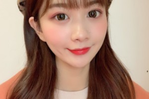 北京聯(lián)合麗格是三甲醫(yī)院嗎？附醫(yī)院介紹+雙眼皮果圖