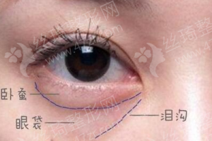 咸陽(yáng)做射頻緊膚機(jī)構(gòu)排名射頻緊膚案例過程分享,射頻緊膚項(xiàng)目術(shù)后體驗(yàn)日記點(diǎn)評(píng)-醫(yī)院實(shí)力簡(jiǎn)介