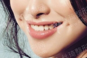 青島做牙齒種植機構(gòu)排名牙齒種植醫(yī)生術(shù)后體驗過程點評!醫(yī)院優(yōu)勢簡介-醫(yī)院優(yōu)勢盤點